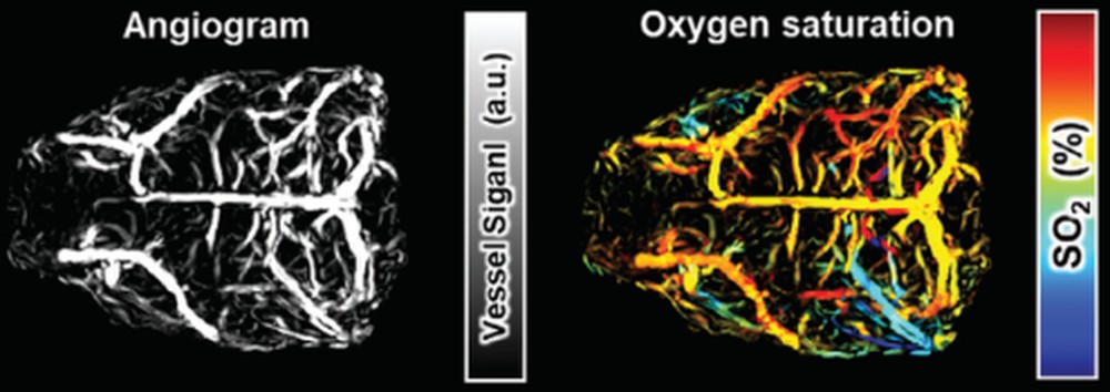 Whole-brain angiogram and oxygen saturation