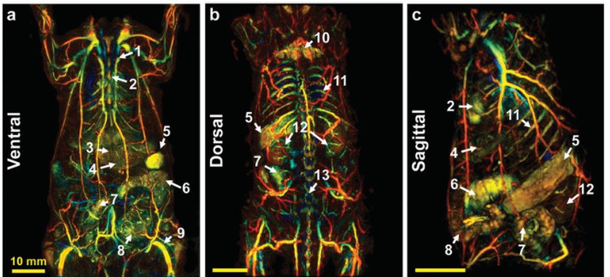 Multiplane whole-body photoacoustic imaging