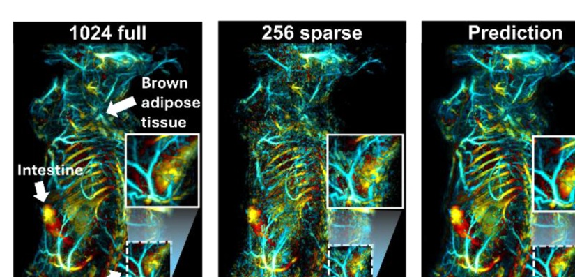 AI-enhanced quantitative photoacoustic imaging