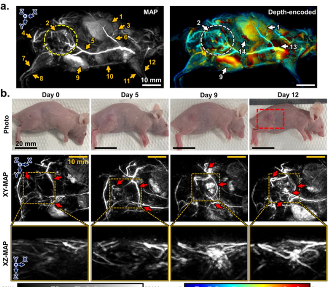 Longitudinal disease monitoring and quantitative imaging biomarkers