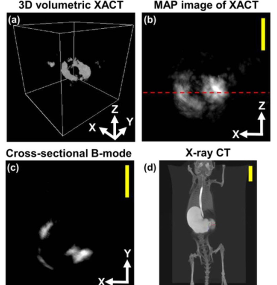 In situ X-ray induced acoustic computed tomography